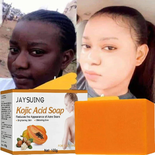 100g Kojic Acid Soap Original Papaya Soap Face Body Whitening Handmade Brighten Anti Aging Acne Remove Dark Spot Moisturizing SHOWLU FASHION STORE