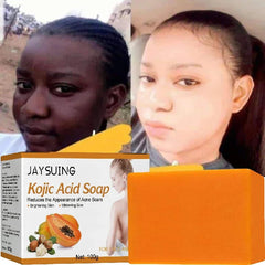 100g Kojic Acid Soap Original Papaya Soap Face Body Whitening Handmade Brighten Anti Aging Acne Remove Dark Spot Moisturizing SHOWLU FASHION STORE