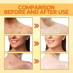 100g Kojic Acid Soap Original Papaya Soap Face Body Whitening Handmade Brighten Anti Aging Acne Remove Dark Spot Moisturizing SHOWLU FASHION STORE