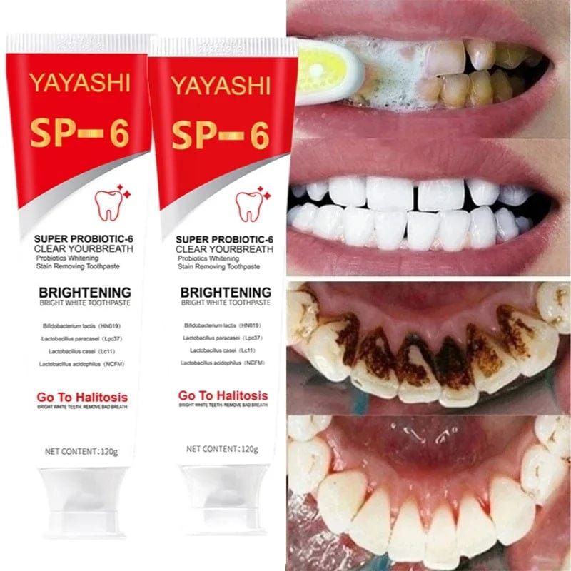 Probiotic Toothpaste SP - 6 Whitening Tooth Remove Plaque Stains Teeth Whitener Oral Hygiene Clean Fresh Breath Denta 120g New - SHOWLU FASHION STORE