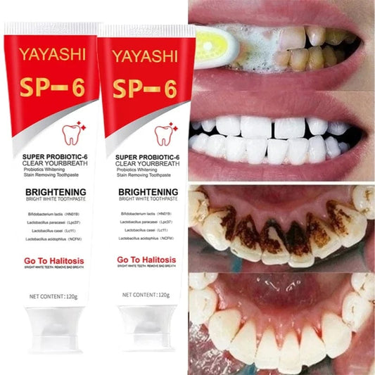 Probiotic Toothpaste SP - 6 Whitening Tooth Remove Plaque Stains Teeth Whitener Oral Hygiene Clean Fresh Breath Denta 120g New - SHOWLU FASHION STORE