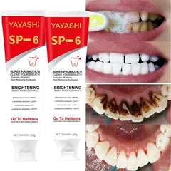 Probiotic Toothpaste SP - 6 Whitening Tooth Remove Plaque Stains Teeth Whitener Oral Hygiene Clean Fresh Breath Denta 120g New - SHOWLU FASHION STORE