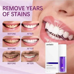SMILEKIT V34 Purple Whitening Toothpaste Remove Smoke Stain Remove Stains Reduce Yellowing Care For Teeth Gums Fresh Breath - SHOWLU FASHION STORE